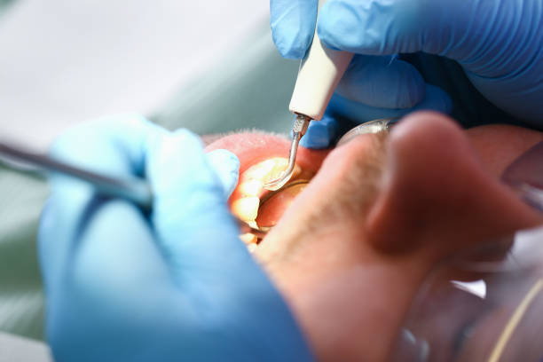 Best Emergency Dental Surgery in Cincinnati, OH